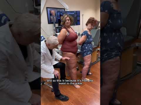 Mother and daughter with Lipedema evalulation with Dr. Wright