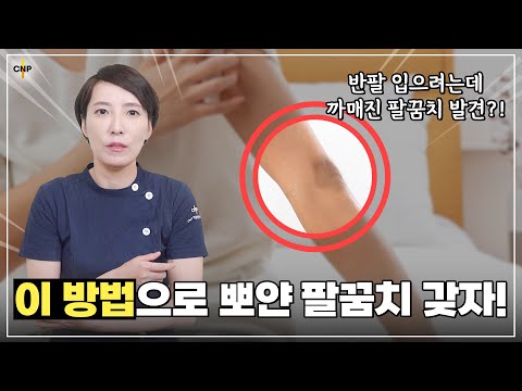 반팔을 입으려는데 까매진 팔꿈치가 고민이라면? 이 영상 하나로 해결 가능합니다!