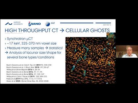 Unlocking the secrets of bone by multimodal and multi-length-scale X-ray 3D imaging