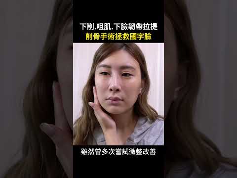 KK女皇蜜蜜削骨記錄心得分享大公開 台北教主 Dr.郭菁松醫師