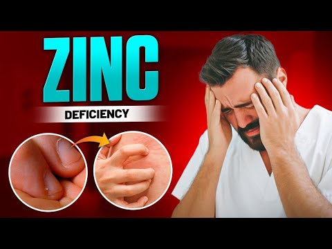 8 Zinc Deficiency Red Flags That Your Body is Silently Screaming.