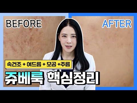 속건조 & 여드름 흉터시술! 스킨부스터 쥬베룩 통증과 추천대상