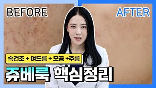 속건조 & 여드름 흉터시술! 스킨부스터 쥬베룩 통증과 추천대상