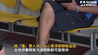 腿「腫」要人命　小心是深部靜脈血栓