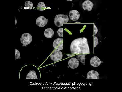 Amoeba defeats Escherichia coli bacteria