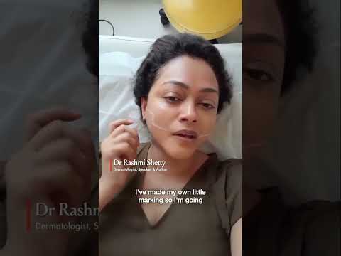 MINI FX + FORMA  By  Dr Rashmi Shetty