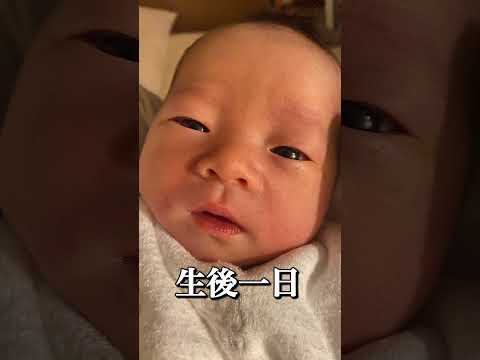 生後1日→生後2年【ビフォーアフター】