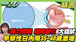 視力模糊 眼睛老化6大症狀！早發性白內障35-40歲激增！【健康2.0精選】