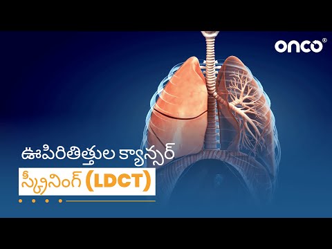 ఊపిరితిత్తుల క్యాన్సర్ స్క్రీనింగ్ LDCT | FAQs Telugu | Onco Cancer Care