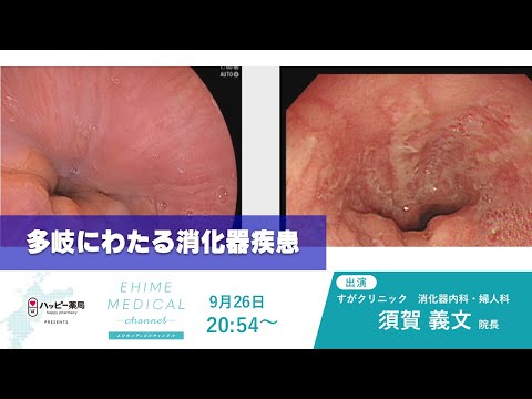 「消化器疾患」EHIME MEDICAL channel(9月26日放送)