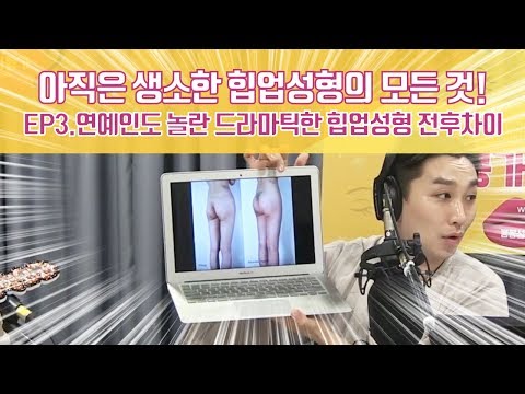 연예인도 놀란 드라마틱한 힙업성형 전후차이