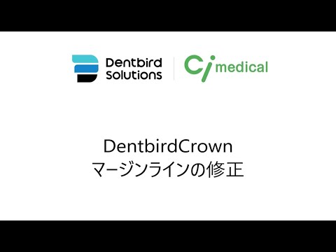 DentbirdCrownマージンラインの修正