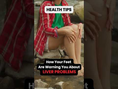 ⚠️ WARNING: What Your FEET Say About Your LIVER Health! 😱 #healthalert #liverdisease #short #shorts