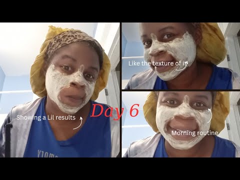 My Clearskin Journey: Day 6 Vlog Revealed