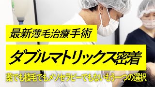 【最新薄毛治療】ダブルマトリックス手術に密着!!