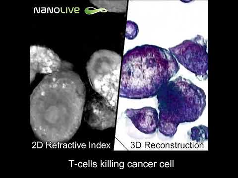 Label free live cell imaging t cells killing cancer cells