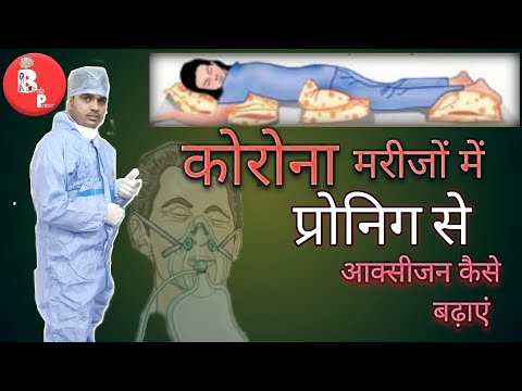 कोरोना मरीजों में प्रोनिग से ऑक्सीजन स्तर में ऐसे कर सकते हैं सुधार