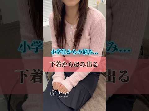 【婦人科形成】下着からはみ出る#shorts