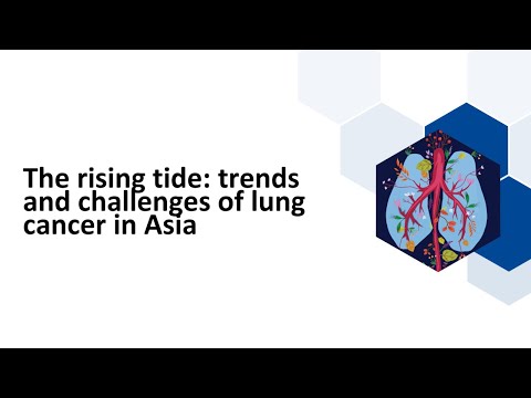 The rising tide: trends and challenges of lung cancer in Asia