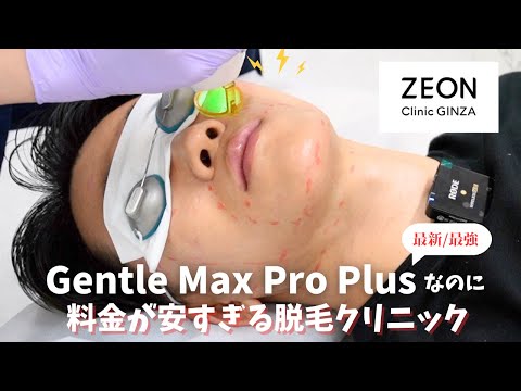 【ZEONクリニック銀座】最強脱毛機 Gentle Max Pro Plusなのに安すぎるクリニックに行ってみた結果・・・