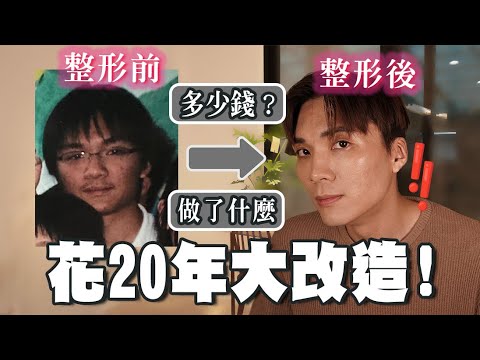 公開20年進化之路🙀痘疤？牙套？差異最多的項目是ＯＯ！做ＯＯ超不推！｜米鹿deerdeer