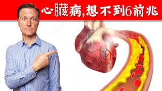 (心臟11) 高血壓與心臟病,心臟病六前兆?柏格醫生 Dr Berg