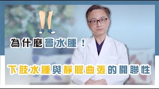 大腿小腿為什麼會水腫？醫師教你如何為大腿小腿消水腫！｜王醫師的靜脈曲張大哉問 EP.6：腿部水腫．靜脈曲張