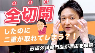 【二重整形】全切開しても二重が取れてしまうことってあるの？形成外科専門医が解説【湘南美容クリニック】