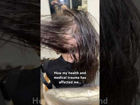 MY MEDICAL TRAUMA 💔 #hairloss #trendingonshorts #youtubeshortsvideo #youtubeshortsviral