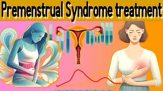 PMS (Premenstrual syndrome) Signs and treatment explained  in 5 minutes