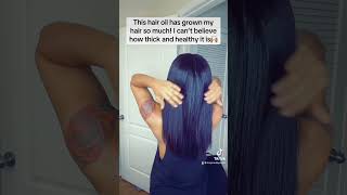 Watch your hair grow💯 #baldingsolution #hairlosstreatment #hairloss #baldhairgrowth