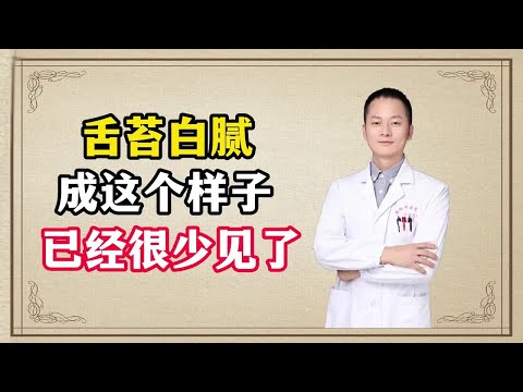 舌苔白腻成这个样子 已经很少见了