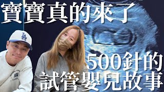 【試管嬰兒（下）】看到小孩動的一刻！淚崩了！我要當爸爸了！500針試管嬰兒故事！【豹子腿方昶詠】#送子鳥 #試管寶寶 #孩子