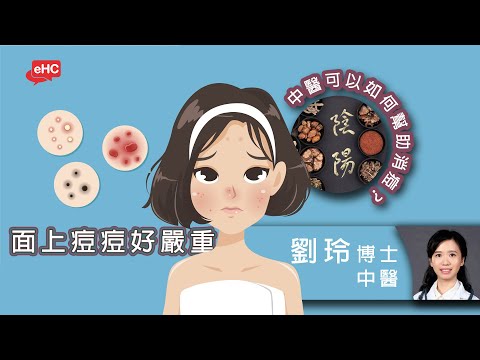 中醫救瘡｜面上痘痘好嚴重  中醫消痘唔一定食中藥