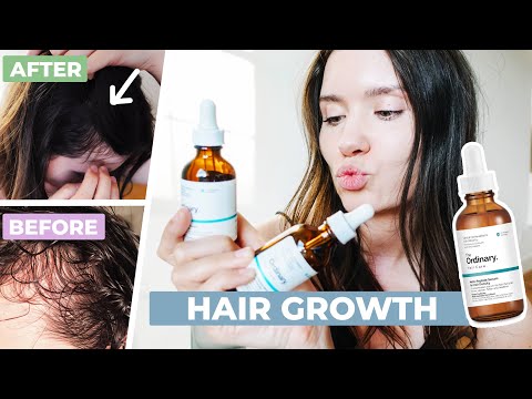 The Ordinary Multi-Peptide Serum for Hair Density Review | Before & After - 1 Year Review