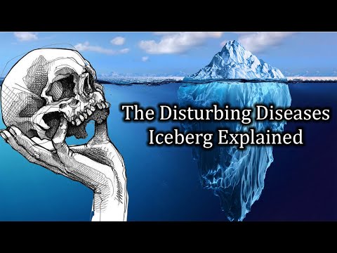 The Obscure And Disturbing Diseases Iceberg Explained.