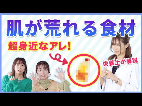 【ニキビを治したいなら〇〇は危険】顔がテカるのは食事が原因？！３つの栄養を押さえて美肌・ダイエット！