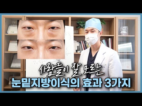 눈밑지방이식을 추천하는 3가지 이유