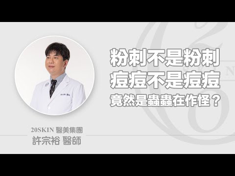 粉刺不是粉刺，痘痘不是痘痘，怎麼回事？