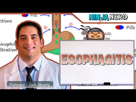 Esophagitis | Clinical Medicine