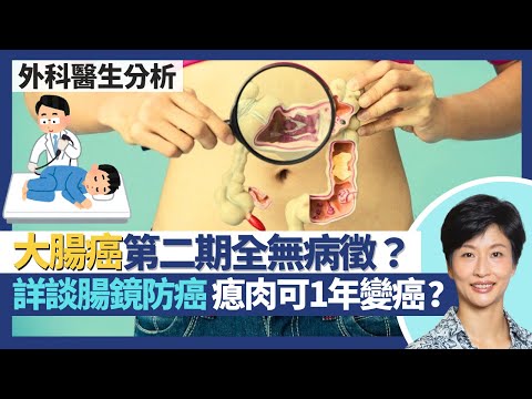 預防大腸癌及腸鏡檢查｜大腸癌直至第二期頭半都無病徵 不適求醫9成已癌症第三期？照大腸鏡5年1次未必夠 部分瘜肉1年已變癌症？詳談腸鏡風險 幾類人要醫院照｜王建芳醫生 外科醫生楊丕祥醫生｜人類健康研究所