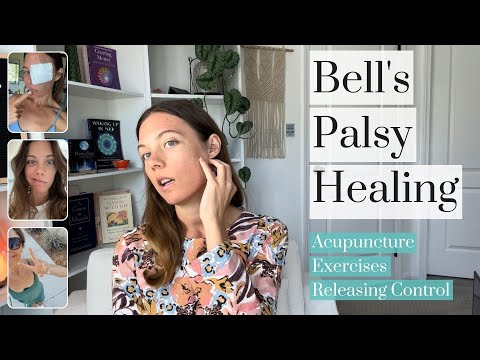 Bell's Palsy Healing Lessons - acupuncture, exercises, releasing control