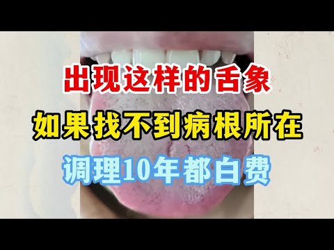 出现这样的舌象，如果找不到病根所在，调理10年都白费