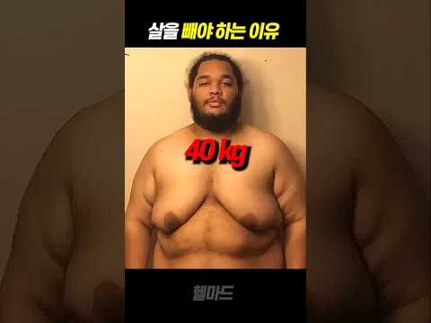 40kg 다이어트 개놀라운 몸 변화 ㄷㄷ