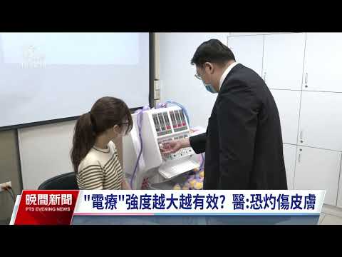 電療強度過大恐灼傷皮膚 醫師：孕婦及癲癇患者也不建議｜20231025 公視晚間新聞