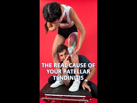 The Real Cause Of Your Patellar Tendonitis