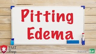 Pitting Edema - EMTprep.com