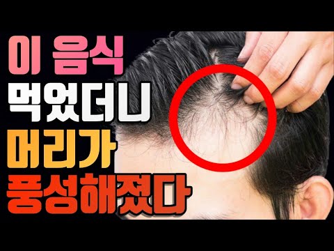 당신의 미래를 바꿀 탈모에 최고 좋은 음식들 / 이 음식들 먹으면 머리가 풍성해진다