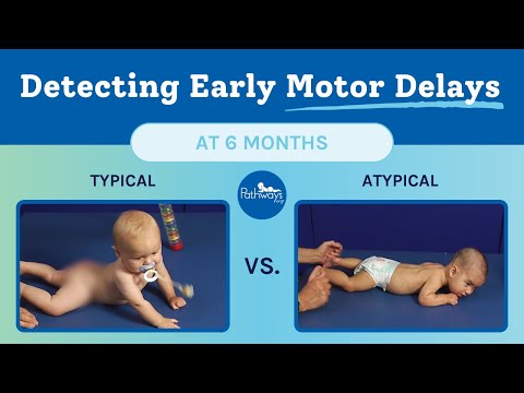 6 Month Typical & Atypical Motor Development | Baby Motor Development Exam