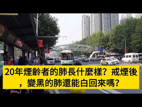 20年煙齡者的肺長什麼樣？戒煙後，變黑的肺還能白回來嗎？#養老#晚年幸福#中老年心語#情感故事